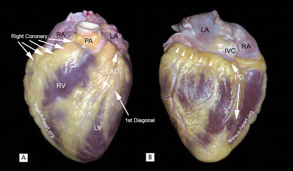 Epicardial Coronaries